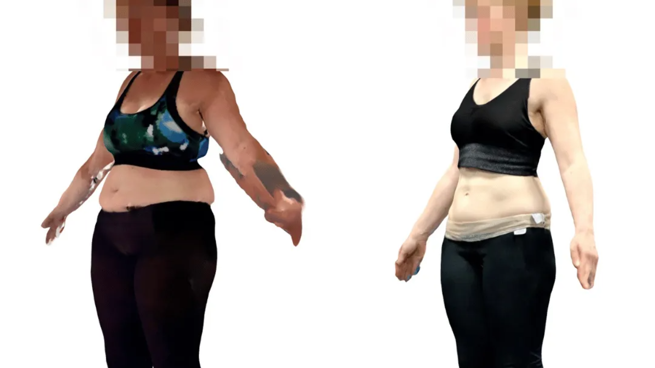 3D Body Scan – Bild 2